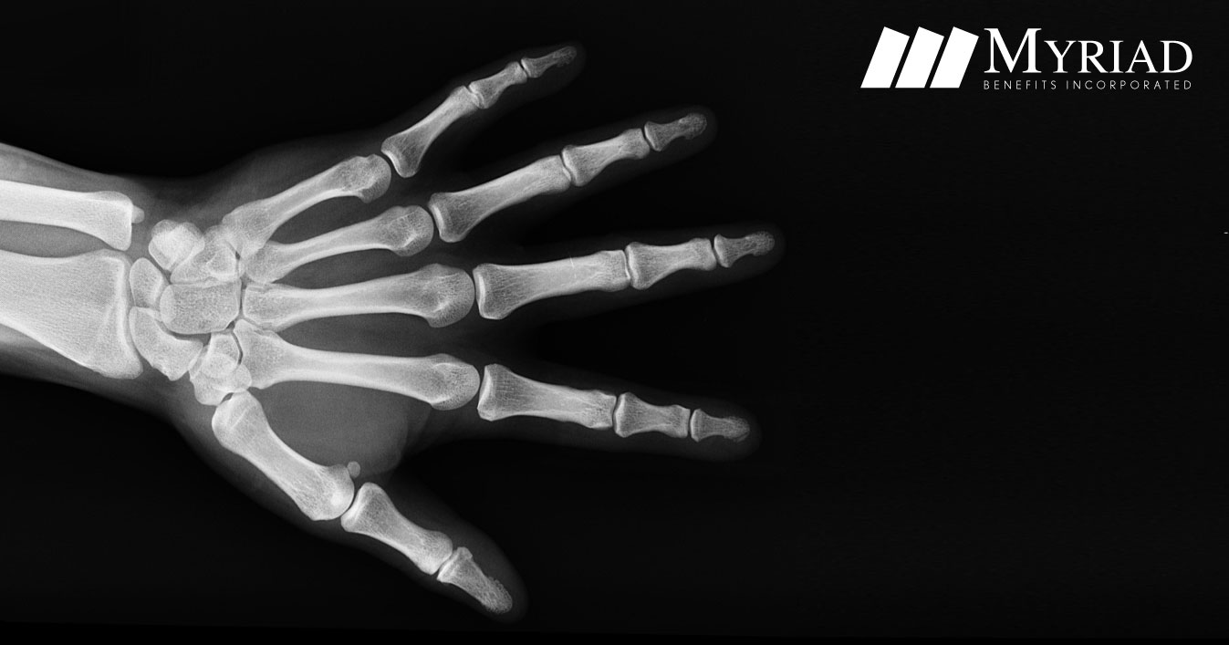 radiografía de la mano