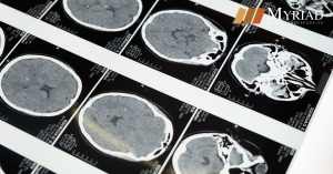 xray cerebro