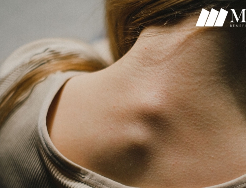 5 consejos para cuidar la salud cervical