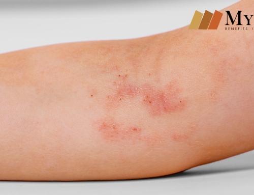 Crea Conciencia y Reconoce La Dermatitis Atópica